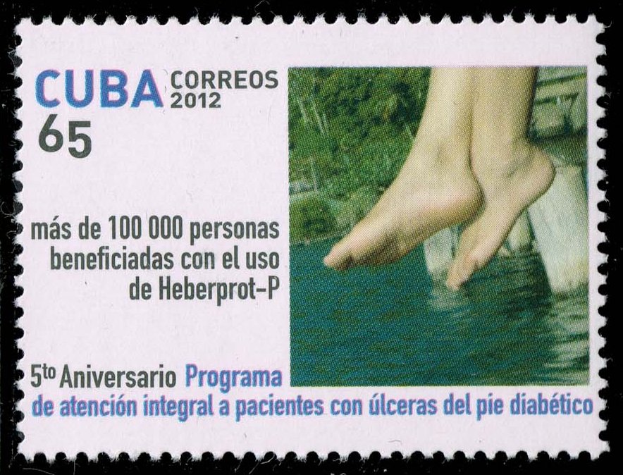 Cuba #5342 Feet; MNH - Click Image to Close